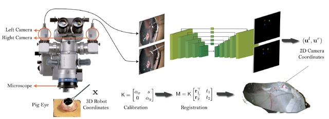 Automatic tool landmark detection for stereo vision in robot-assisted retinal surgery thumbnail