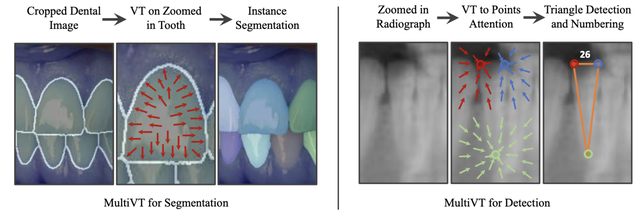 MultiVT: Multiple-Task Framework for Dentistry thumbnail